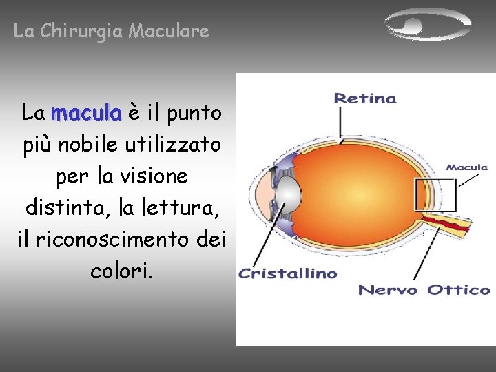 La Chirurgia Maculare La macula è il punto più nobile utilizzato per la visione
