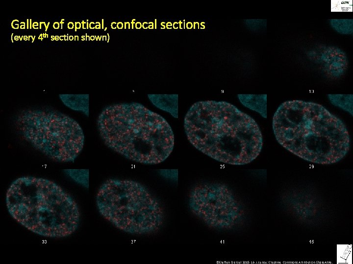 Gallery of optical, confocal sections (every 4 th section shown) ©Steffen Dietzel 2015 -16.