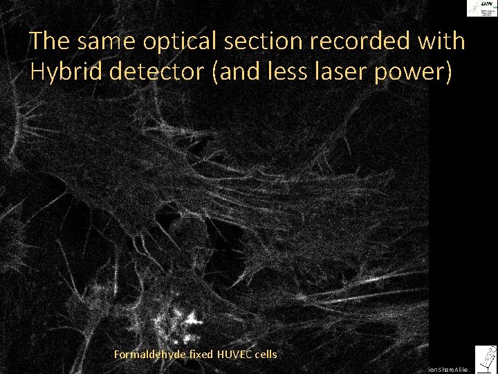 The same optical section recorded with Hybrid detector (and less laser power) Formaldehyde fixed