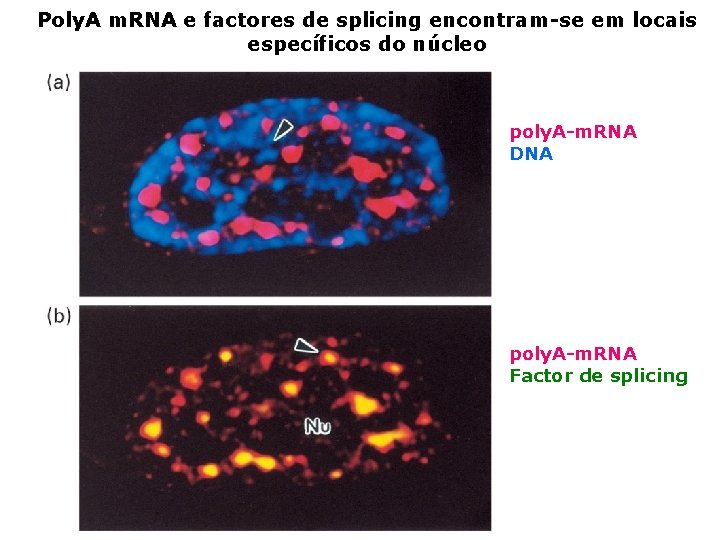 Poly. A m. RNA e factores de splicing encontram-se em locais específicos do núcleo