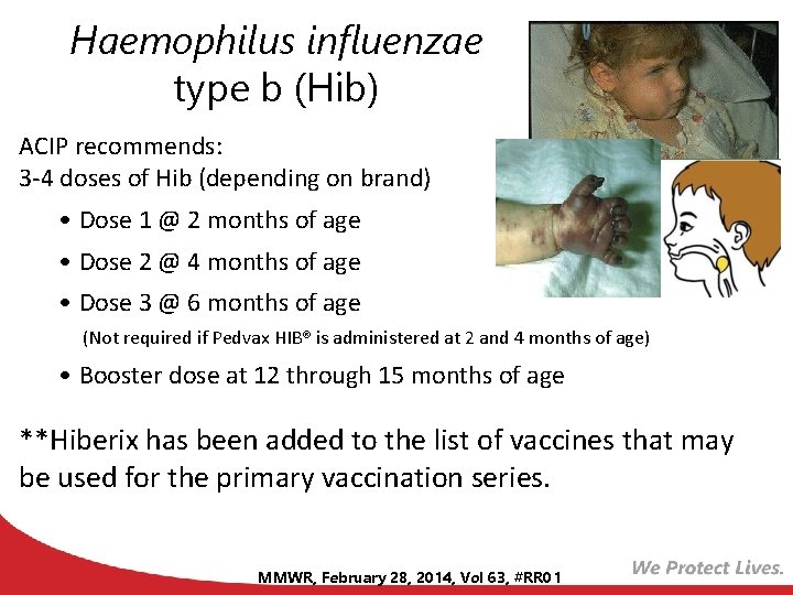 Haemophilus influenzae type b (Hib) ACIP recommends: 3 -4 doses of Hib (depending on