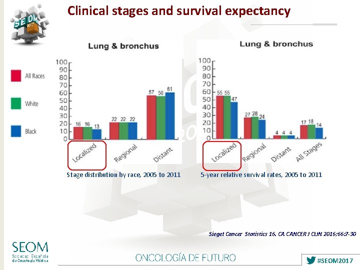 Clinical stages and survival expectancy Stage distribution by race, 2005 to 2011 5 -year