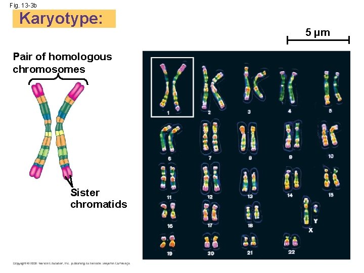 Fig. 13 -3 b Karyotype: Pair of homologous chromosomes Sister chromatids 5 µm 