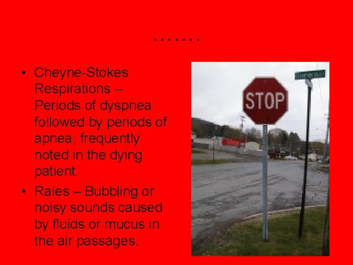 ……. • Cheyne-Stokes Respirations – Periods of dyspnea followed by periods of apnea; frequently