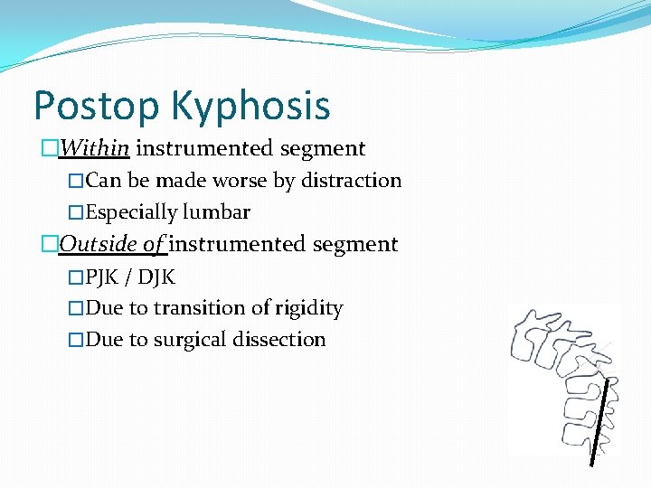 Postop Kyphosis �Within instrumented segment �Can be made worse by distraction �Especially lumbar �Outside