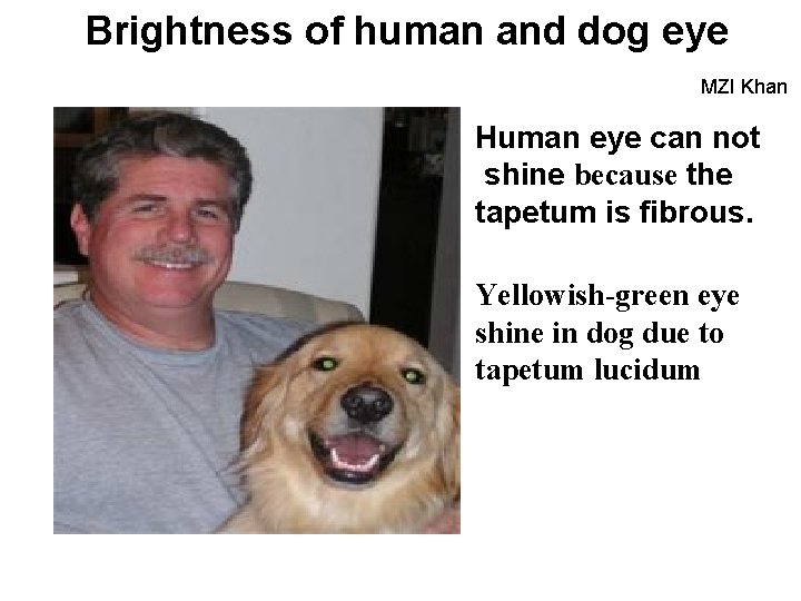 Brightness of human and dog eye MZI Khan Human eye can not shine because
