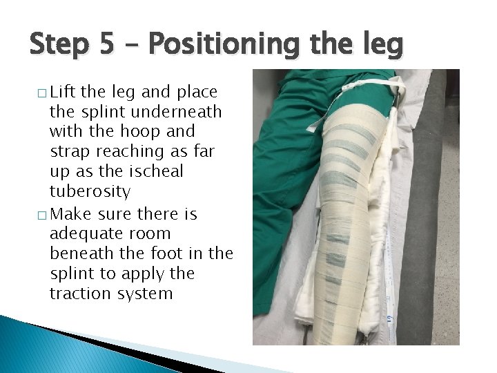 Step 5 – Positioning the leg � Lift the leg and place the splint