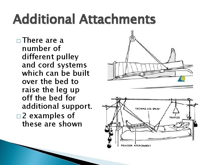 Additional Attachments � There a number of different pulley and cord systems which can