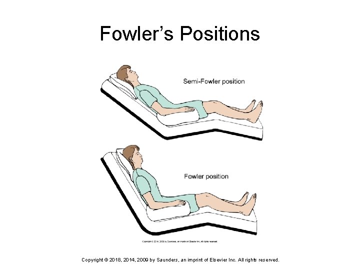 Fowler’s Positions Copyright © 2018, 2014, 2009 by Saunders, an imprint of Elsevier Inc.