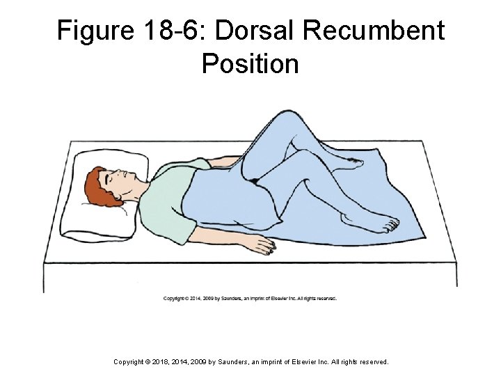 Figure 18 -6: Dorsal Recumbent Position Copyright © 2018, 2014, 2009 by Saunders, an