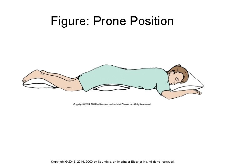 Figure: Prone Position Copyright © 2018, 2014, 2009 by Saunders, an imprint of Elsevier