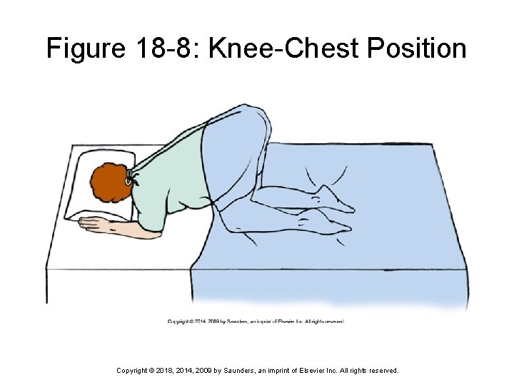 Figure 18 -8: Knee-Chest Position Copyright © 2018, 2014, 2009 by Saunders, an imprint