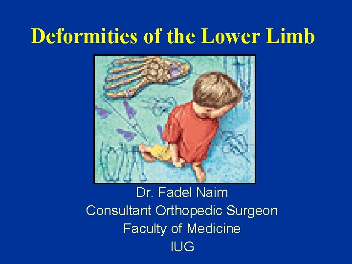 Deformities of the Lower Limb Dr. Fadel Naim Consultant Orthopedic Surgeon Faculty of Medicine