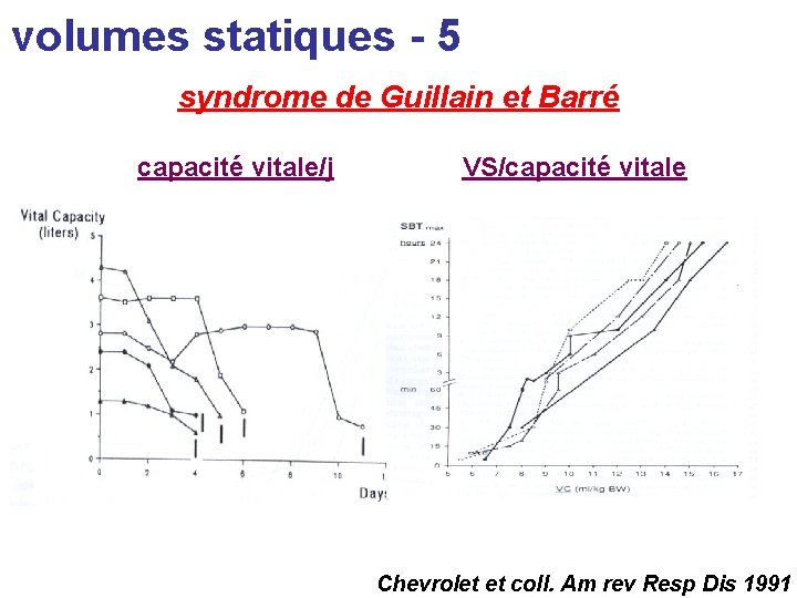 volumes statiques - 5 syndrome de Guillain et Barré capacité vitale/j VS/capacité vitale Chevrolet