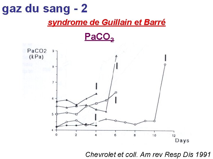 gaz du sang - 2 syndrome de Guillain et Barré Pa. CO 2 Chevrolet