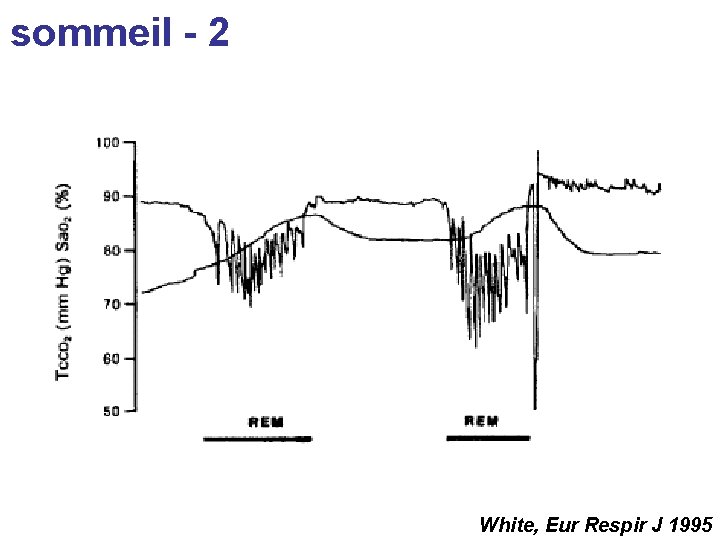 sommeil - 2 White, Eur Respir J 1995 