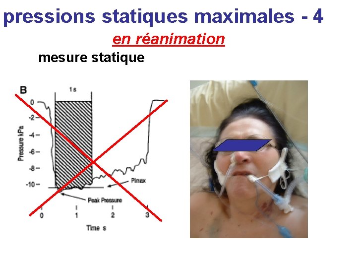 pressions statiques maximales - 4 en réanimation mesure statique 
