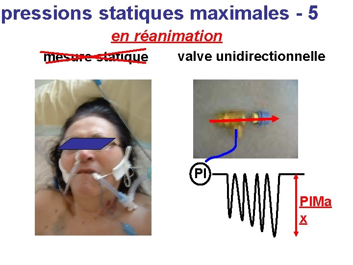 pressions statiques maximales - 5 en réanimation mesure statique valve unidirectionnelle PI PIMa x