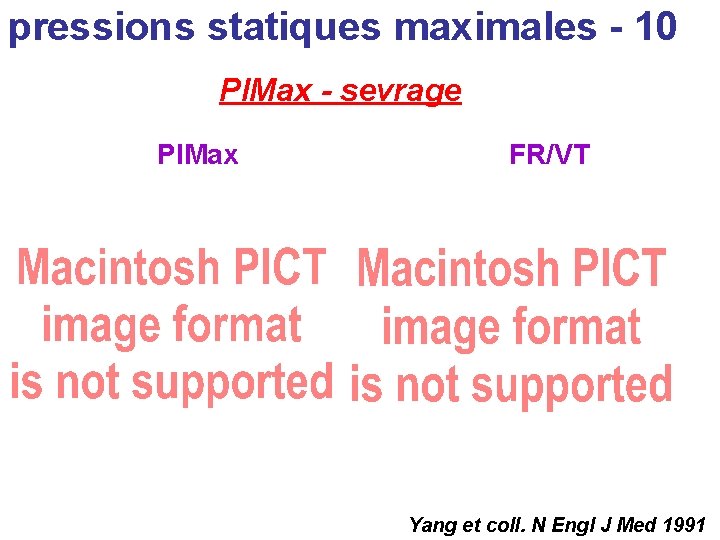 pressions statiques maximales - 10 PIMax - sevrage PIMax FR/VT Yang et coll. N