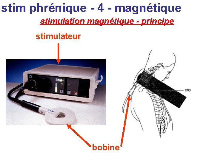 stim phrénique - 4 - magnétique stimulation magnétique - principe stimulateur bobine 