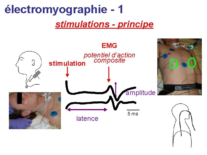 électromyographie - 1 stimulations - principe EMG potentiel d’action stimulation composite amplitude latence 