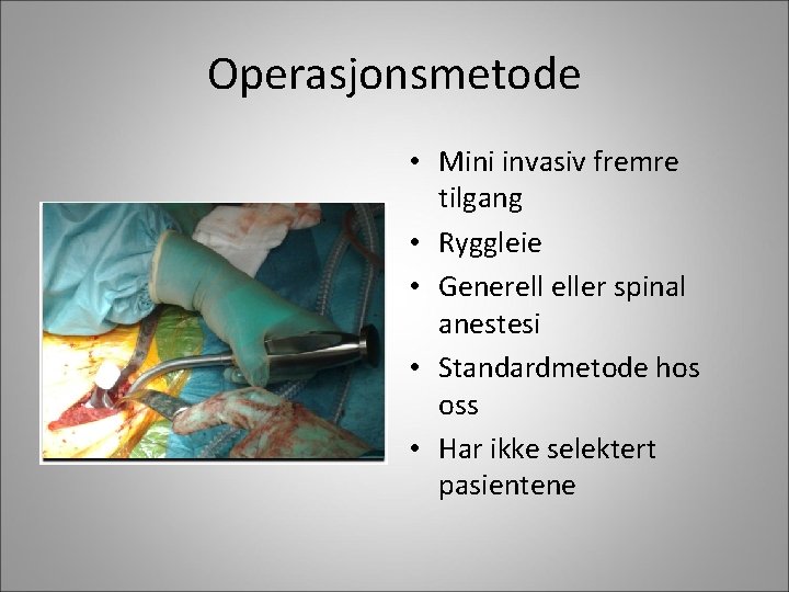 Operasjonsmetode • Mini invasiv fremre tilgang • Ryggleie • Generell eller spinal anestesi •