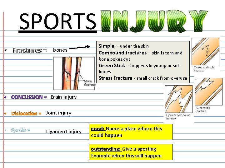 SPORTS • Fractures = bones Simple – under the skin Compound fractures – skin