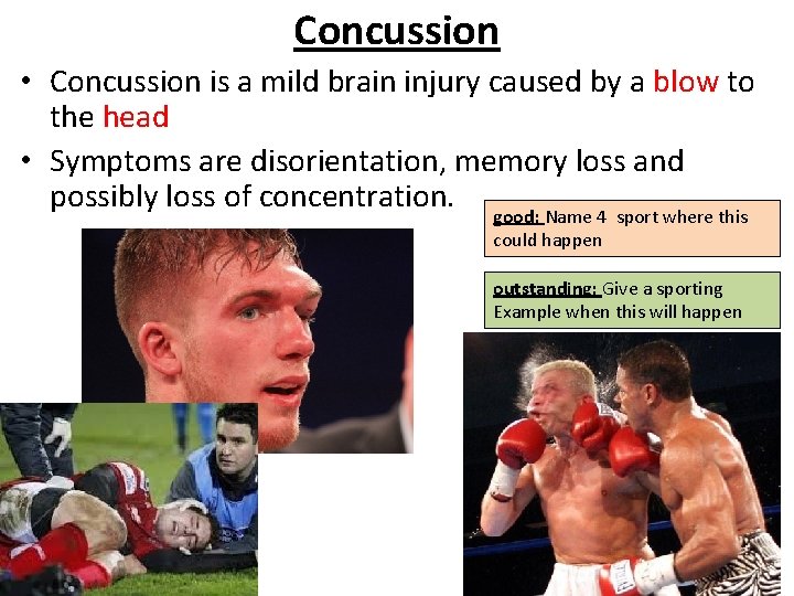 Concussion • Concussion is a mild brain injury caused by a blow to the