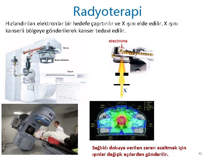 Radyoterapi Hızlandırılan elektronlar bir hedefe çaprtırılır ve X ışını elde edilir. X ışını kanserli