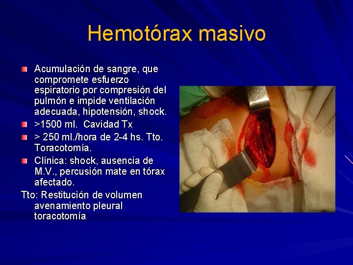Hemotórax masivo Acumulación de sangre, que compromete esfuerzo espiratorio por compresión del pulmón e