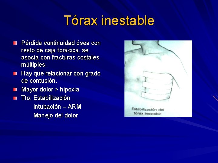 Tórax inestable Pérdida continuidad ósea con resto de caja torácica, se asocia con fracturas