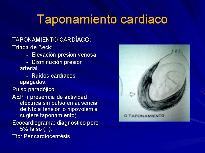 Taponamiento cardiaco TAPONAMIENTO CARDÍACO: Tríada de Beck: - Elevación presión venosa - Disminución presión