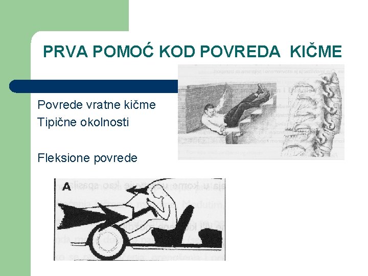 PRVA POMOĆ KOD POVREDA KIČME Povrede vratne kičme Tipične okolnosti Fleksione povrede 