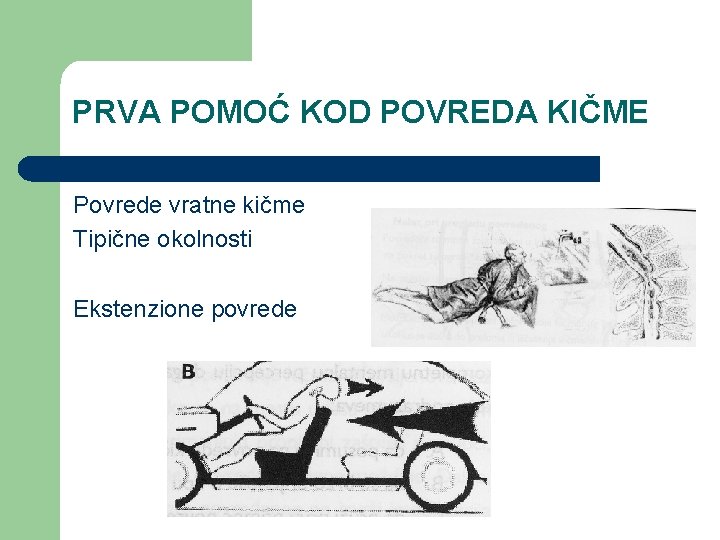 PRVA POMOĆ KOD POVREDA KIČME Povrede vratne kičme Tipične okolnosti Ekstenzione povrede 