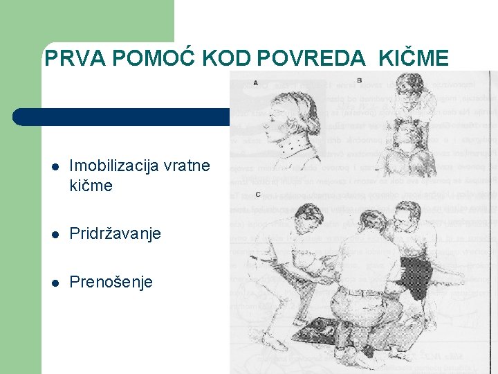 PRVA POMOĆ KOD POVREDA KIČME l Imobilizacija vratne kičme l Pridržavanje l Prenošenje 