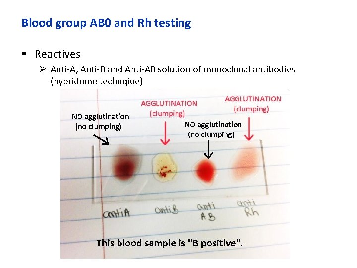 Blood group AB 0 and Rh testing § Reactives Ø Anti-A, Anti-B and Anti-AB