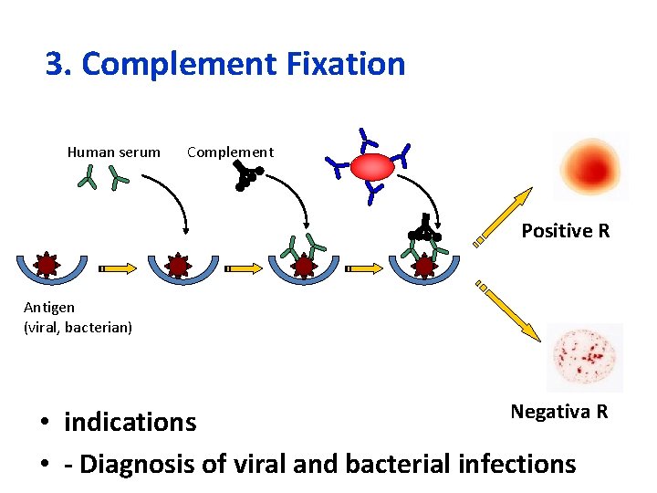 3. Complement Fixation Human serum Complement Positive R Antigen (viral, bacterian) Negativa R •