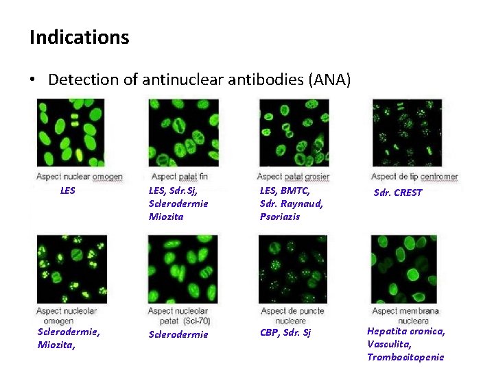 Indications • Detection of antinuclear antibodies (ANA) LES, Sdr. Sj, Sclerodermie Miozita LES, BMTC,