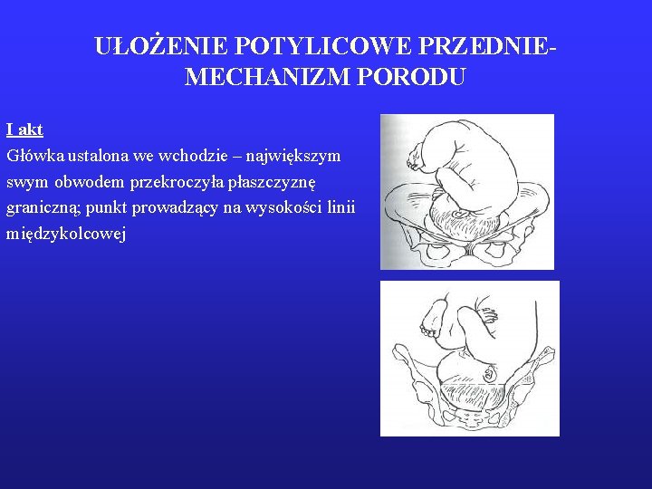 UŁOŻENIE POTYLICOWE PRZEDNIEMECHANIZM PORODU I akt Główka ustalona we wchodzie – największym swym obwodem