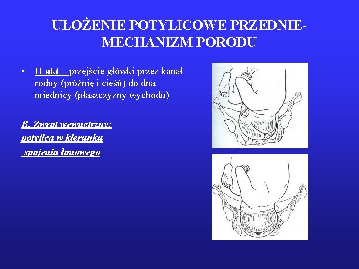 UŁOŻENIE POTYLICOWE PRZEDNIEMECHANIZM PORODU • II akt – przejście główki przez kanał rodny (próżnię