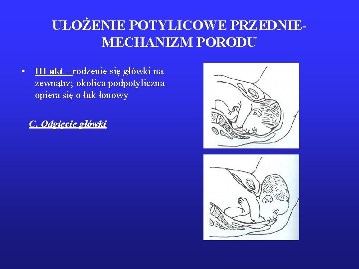 UŁOŻENIE POTYLICOWE PRZEDNIEMECHANIZM PORODU • III akt – rodzenie się główki na zewnątrz; okolica