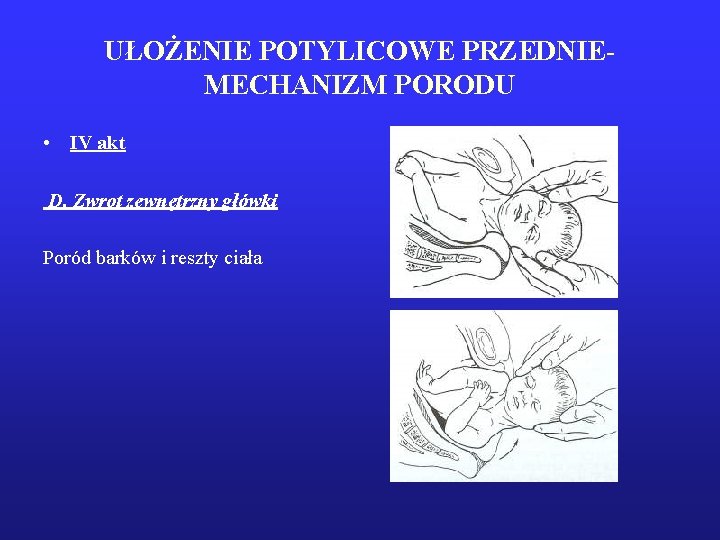 UŁOŻENIE POTYLICOWE PRZEDNIEMECHANIZM PORODU • IV akt D. Zwrot zewnętrzny główki Poród barków i