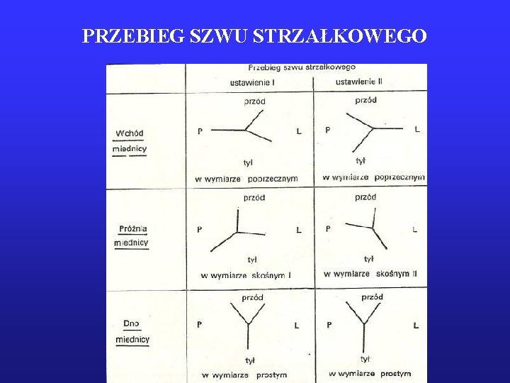 PRZEBIEG SZWU STRZAŁKOWEGO 