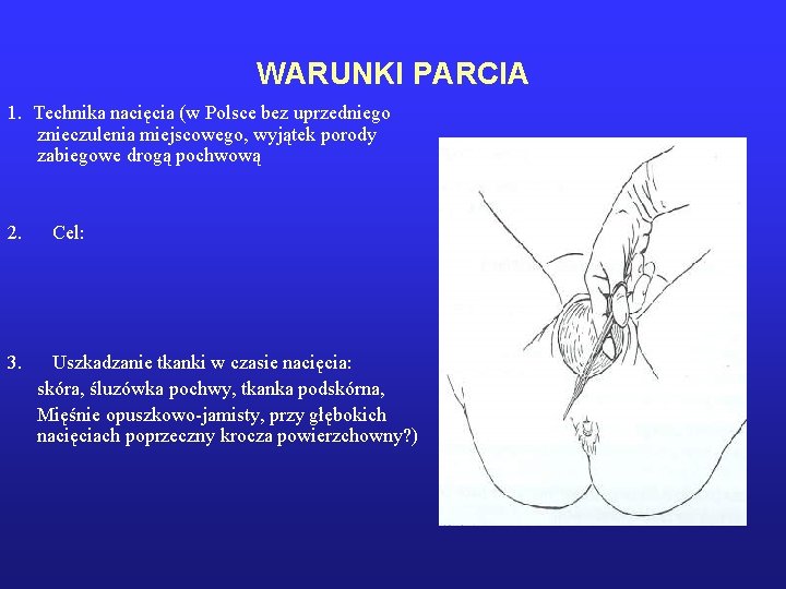 WARUNKI PARCIA 1. Technika nacięcia (w Polsce bez uprzedniego znieczulenia miejscowego, wyjątek porody zabiegowe