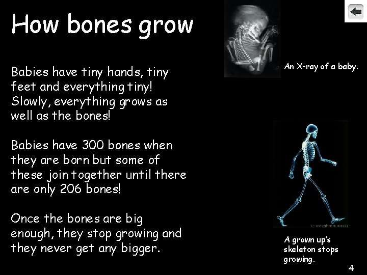 How bones grow Babies have tiny hands, tiny feet and everything tiny! Slowly, everything