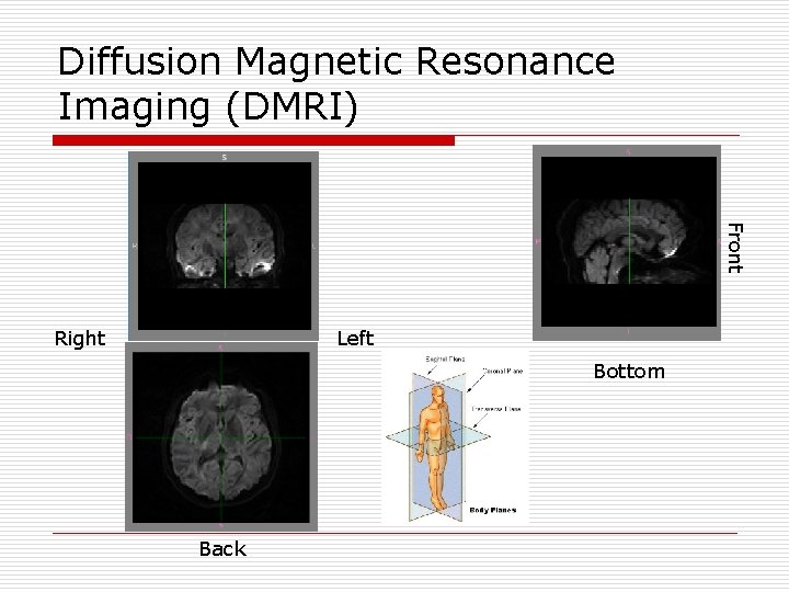 Diffusion Magnetic Resonance Imaging (DMRI) Front Right Left Bottom Back 