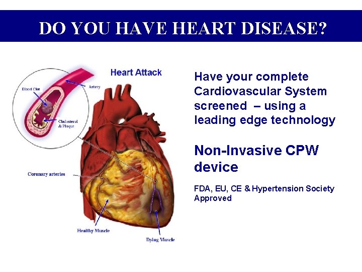 DO YOU HAVE HEART DISEASE? Have your complete Cardiovascular System screened – using a DO YOU HAVE HEART DISEASE? Have your complete Cardiovascular System screened – using a