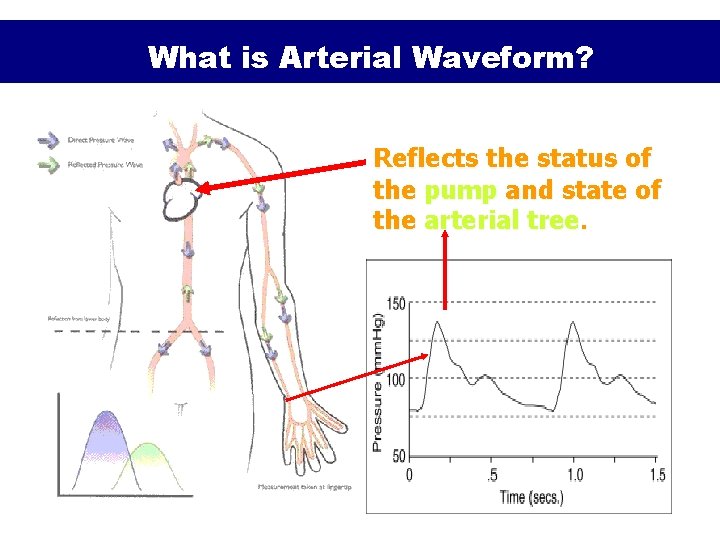 What is Arterial Waveform? Reflects the status of the pump and state of the What is Arterial Waveform? Reflects the status of the pump and state of the