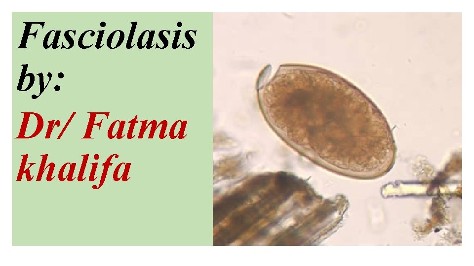 Fasciolasis by: Dr/ Fatma khalifa 