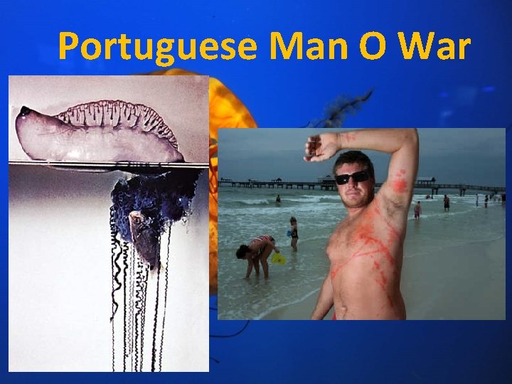 Portuguese Man O War 